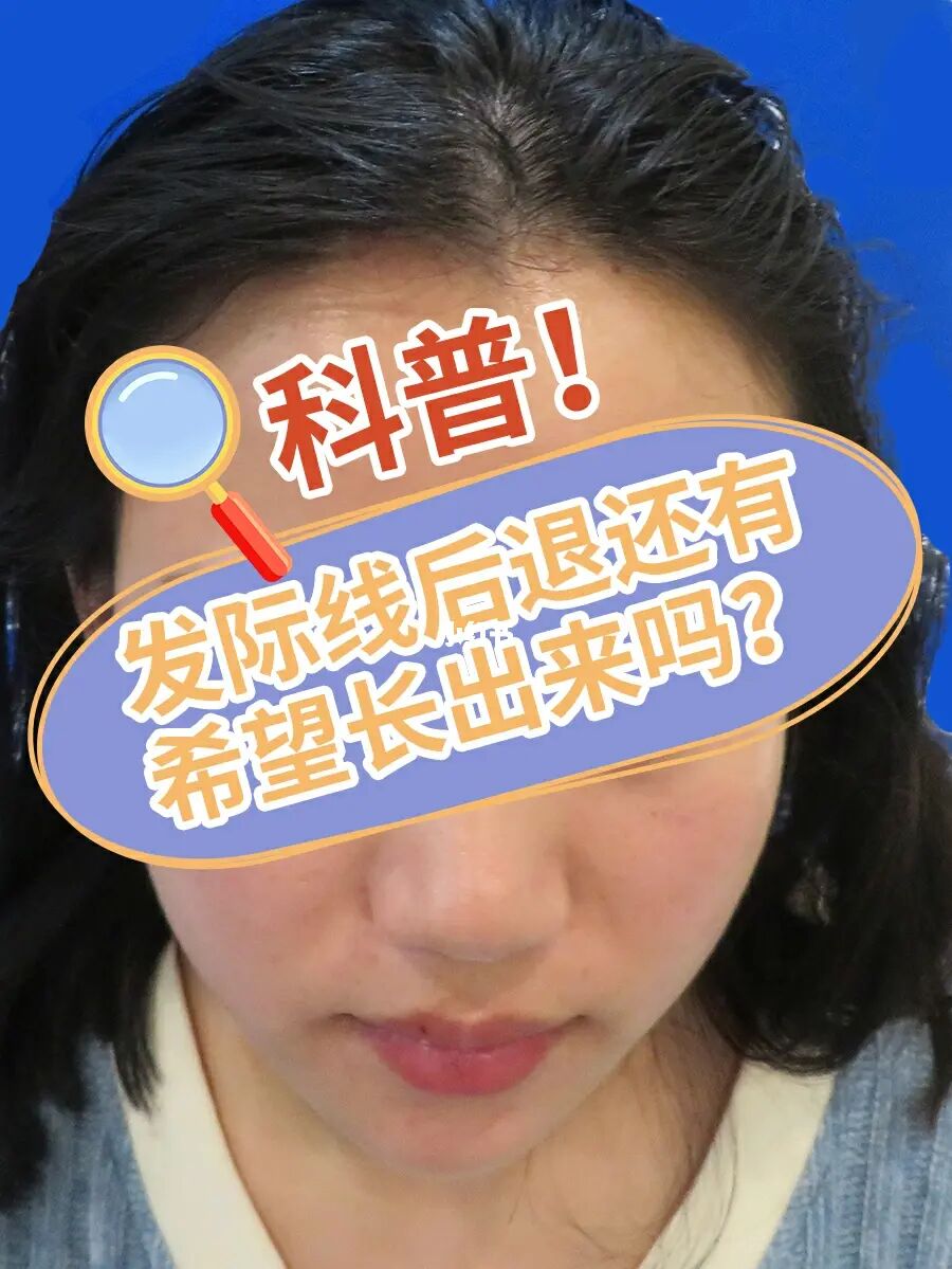 肩膀脱臼多久能恢复好_切除眼袋多久能恢复好_整发际线多久能恢复好